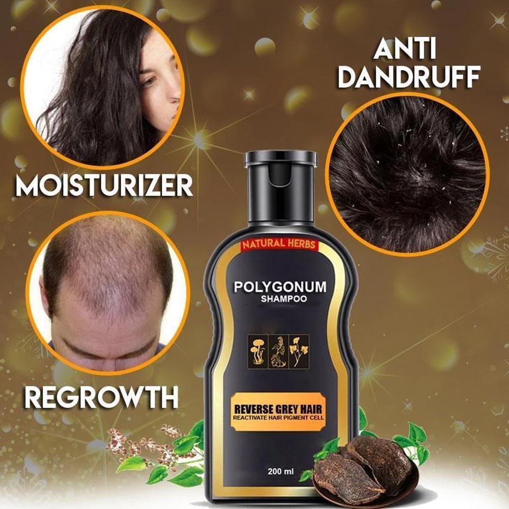 200ml Hair Loss Treatment Shampoo Hair care Shampoo