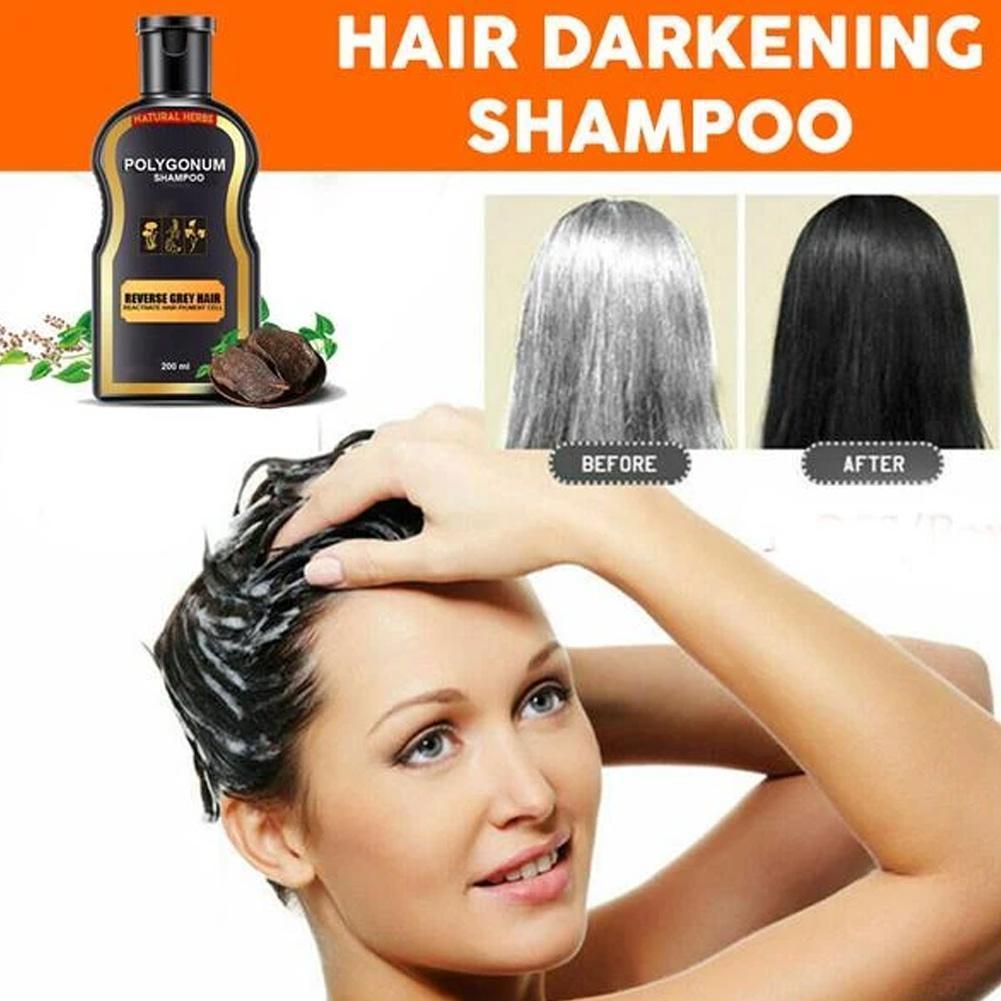 200ml Hair Loss Treatment Shampoo Hair care Shampoo